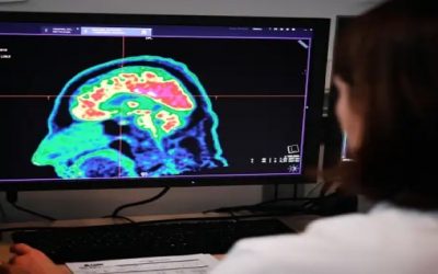 Lo que las experiencias traumáticas le hacen al cerebro y al cuerpo
