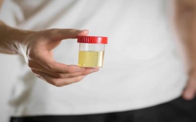 Cáncer de próstata podría desencadenarse por bacterias en la orina