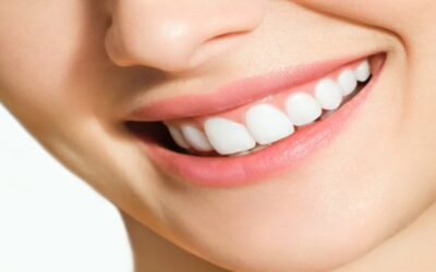 Periodontitis: el problema en las encías que puede afectar seriamente tu salud mucho más allá de tu boca