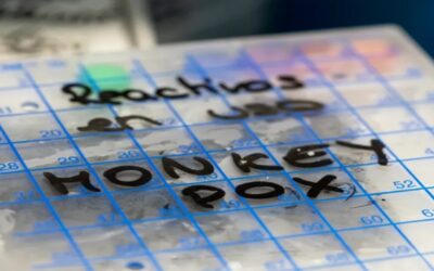 Los CDC reportaron primeros casos de viruela del mono en niños de EE.UU.