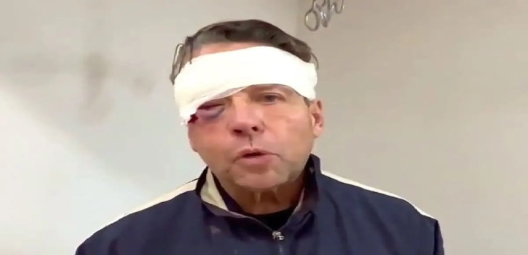 Alfredo Adame señala que necesitará tratamiento psicológico tras golpiza