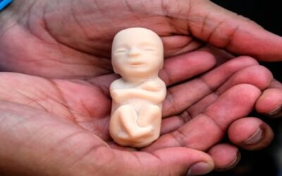 Restricción del aborto en EE.UU. aumentaría el riesgo de suicidio entre las mujeres de 20 a 34 años, advierte investigación