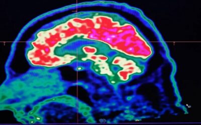 Científicos desarrollan una vacuna que mata y previene el cáncer de cerebro