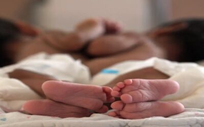 Dos gemelas siamesas hispanas son separadas tras una “cirugía histórica” de 11 horas en Texas