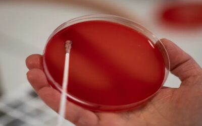 Candida auris en Estados Unidos: qué es, cuáles son sus síntomas y cómo es su tratamiento