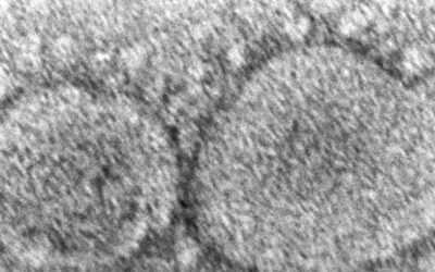 EEUU: Cámara vota hacer públicos orígenes del COVID-19