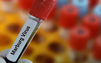 Virus Marburg: qué es y por qué los CDC advierten a quienes viajan a Estados Unidos