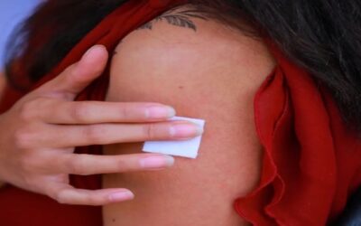 Parche que administra fármacos a través de la piel sin dolor podría acabar con las inyecciones