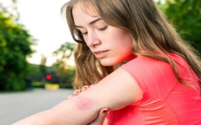 Qué es el virus del Nilo Occidental y cómo afecta a los habitantes de EE. UU.