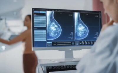 Cáncer de mama podría predecirse mejor con la inteligencia artificial