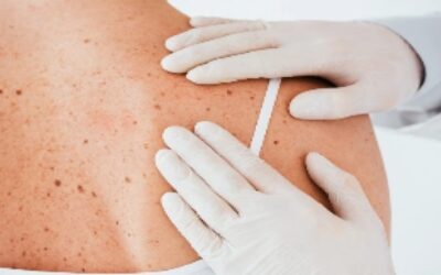 RIDOH ofrece 5 fechas para exámenes de piel en playas y parques estatales.