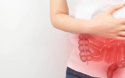 Cómo el síndrome de intestino irritable puede afectarte durante las festividades