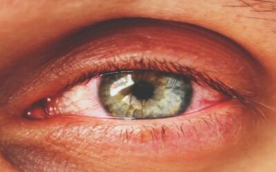 Aumentan casos de sífilis ocular en EE.UU.