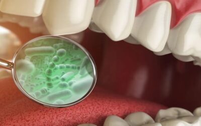 Los peligros de las bacterias bucales: 4 enfermedades que debes conocer