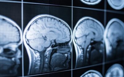 Cómo se comporta el cerebro luego de la muerte: esto dice un estudio