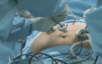 Cada vez más adolescentes estadounidenses se someten a cirugía para perder peso