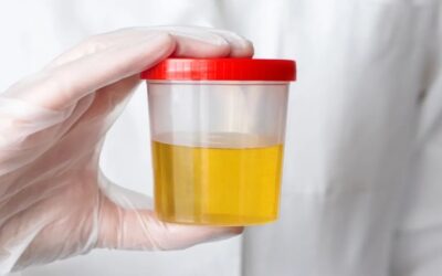 Una prueba de orina podría ayudar a detectar el cáncer de próstata