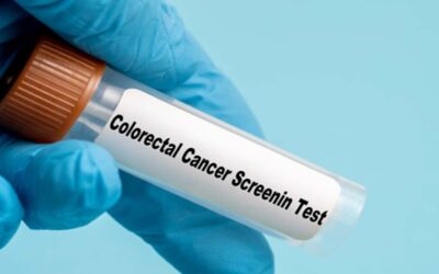 Sugieren que bebidas azucaradas tienen incidencia directa en la propagación del cáncer colorrectal