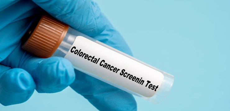 Sugieren que bebidas azucaradas tienen incidencia directa en la propagación del cáncer colorrectal