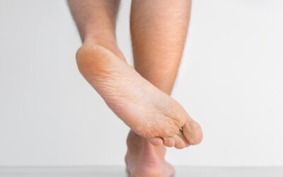 Protégete de los hongos en los pies con estos sencillos pasos