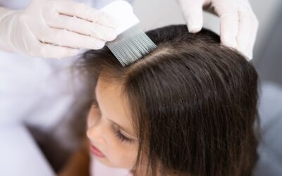 Conflicto en colegios: los piojos no son una amenaza para la salud, pero padres se niegan a que sus hijos queden expuestos