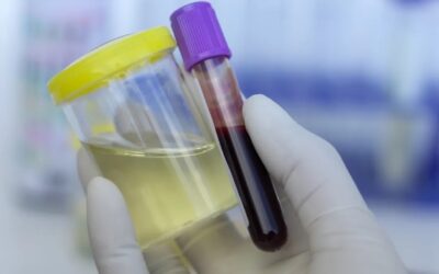 Exámenes de orina y de sangre son pruebas de detección: ¿en qué se diferencian, cuál debes hacerte?