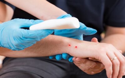 ¿Qué riesgos corres tras una mordida de animal?