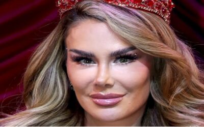 ¿En qué consiste la queratopigmentación ocular, el tratamiento que está de moda entre los famosos?