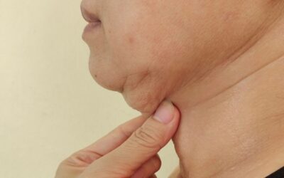 El grosor del cuello puede indicar mucho sobre tu salud
