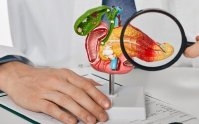 Cáncer de páncreas, uno de los más agresivos