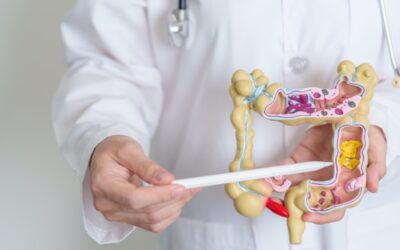 Diverticulitis: los alimentos que debes evitar para proteger tu salud intestinal