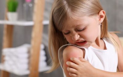 Estudio revela el incremento de alergias alimentarias en niños