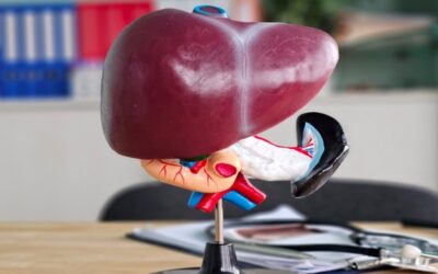 Esteatosis hepática o hígado graso: la enfermedad silenciosa que afecta a un tercio de la población