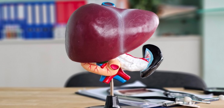 Esteatosis hepática o hígado graso: la enfermedad silenciosa que afecta a un tercio de la población