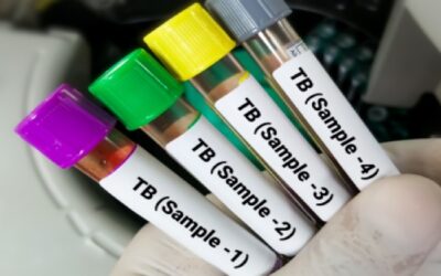 Aumentan casos de la “peste blanca” en EE.UU.