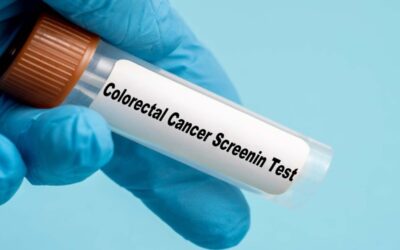 Incremento del cáncer colorrectal, una alarma global: síntomas tempranos y recomendaciones preventivas