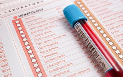 Cansado, con sueño, esta puede ser la causa.