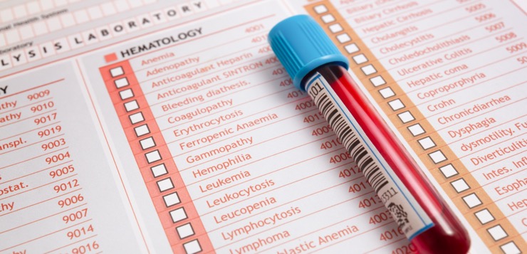 Cansado, con sueño, esta puede ser la causa.