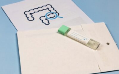 Alarma aumento de cáncer de recto entre millennials