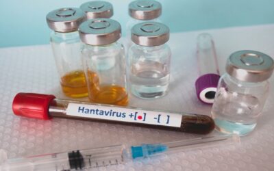 Reapareció el hantavirus: ¿de qué se trata este brote?