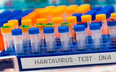 El hantavirus es altamente contagioso al inicio, advierte la OMS. Recomiendan cuarentena para casos sospechosos