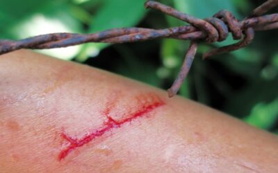 Aumentan casos de tétanos, es una enfermedad rara pero peligrosa