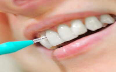 Los espacios entre los dientes también necesitan limpieza: cómo usar correctamente el cepillo interproximal