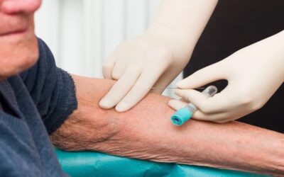Nuevo análisis de sangre podría predecir el riesgo de Alzheimer hasta 10 años antes de los síntomas, según estudio