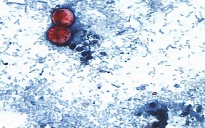 México confirma 33 casos de cyclospora y activa vigilancia epidemiológica